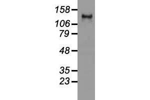Western blot analysis of 35 µg of cell extracts from human (HeLa) cells using anti-L1CAM antibody. (L1CAM antibody)