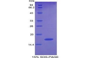 SDS-PAGE of Protein Standard from the Kit (Highly purified E. (Pleiotrophin CLIA Kit)