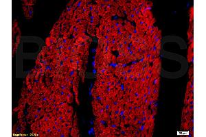 Formalin-fixed and paraffin embedded rat heart tissue labeled with Rabbit Anti-DOG-1/TMEM16A Polyclonal Antibody, Unconjugated (ABIN704216) at 1:200 followed by conjugation to the secondary antibody and DAB staining. (ANO1 antibody  (AA 151-250))