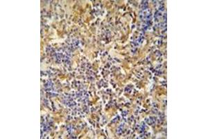 Immunohistochemistry analysis in formalin fixed and paraffin embedded human lymph tissue reacted with IBTK / BTKI Antibody (Center) followed which was peroxidase conjugated to the secondary antibody and followed by DAB staining. (IBTK antibody  (Middle Region))