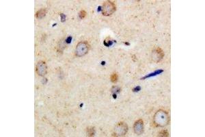 Immunohistochemical analysis of PSMD11 staining in human brain formalin fixed paraffin embedded tissue section. (PSMD11 antibody)