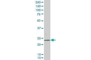 RAB43 monoclonal antibody (M01), clone 5G4 Western Blot analysis of RAB43 expression in HepG2 . (RAB43 antibody  (AA 113-210))