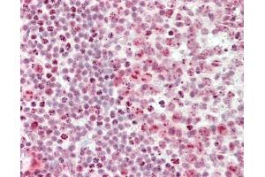 Human Tonsil: Formalin-Fixed, Paraffin-Embedded (FFPE). (CSTF3 antibody  (AA 71-120))
