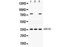 Western blot analysis of AKR1B1 expression in rat cardiac muscle extract ( Lane 1), human placenta extract ( Lane 2) and HELA whole cell lysates ( Lane 3).