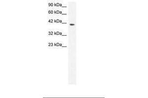 Image no. 3 for anti-Matrix Metallopeptidase 19 (MMP19) (AA 56-105) antibody (ABIN6735807) (MMP19 antibody  (AA 56-105))