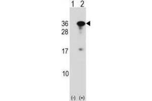 Western Blotting (WB) image for anti-RING1 and YY1 Binding Protein (RYBP) antibody (ABIN2998877)