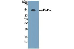 Detection of Recombinant MCP2, Bovine using Polyclonal Antibody to Monocyte Chemotactic Protein 2 (MCP2) (CCL8 antibody  (AA 1-99))