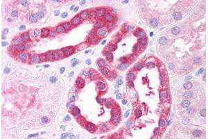 Human Renal Tubular Epithelium (formalin-fixed, paraffin-embedded) stained with RICTOR antibody ABIN297558 at 2. (RICTOR antibody  (AA 1722-1732))