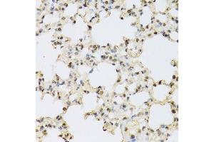Immunohistochemistry (Paraffin-embedded Sections) (IHC (p)) image for anti-Mitogen-Activated Protein Kinase 3 (MAPK3) (AA 1-100) antibody (ABIN3020725)