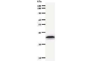 Western Blotting (WB) image for anti-Ubinuclein 1 (UBN1) antibody (ABIN930942) (Ubinuclein 1 antibody)