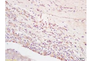 Formalin-fixed and paraffin embedded rat brain labeled with Rabbit Anti Integrin Alpha V + Beta 3 (CD51+CD61) Polyclonal Antibody, Unconjugated (ABIN674784) at 1:200 followed by conjugation to the secondary antibody and DAB staining (CD51/CD61 antibody)