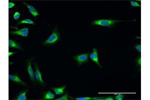 Immunofluorescence (IF) image for anti-Protein Disulfide Isomerase Family A, Member 3 (PDIA3) (AA 1-505) antibody (ABIN950005)