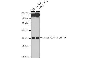 Western blot analysis of extracts of various cell lines, using Annexin /Annexin IV antibody (ABIN6127353, ABIN6136931, ABIN6136933 and ABIN6217476) at 1:1000 dilution. (Annexin IV antibody  (AA 112-321))
