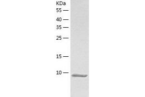 S100G Protein (AA 2-79) (His tag)