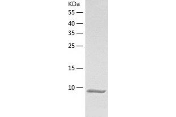 S100G Protein (AA 2-79) (His tag)