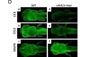 Deregulation of EMT markers and detection of polyploidy in the pectoral fin of cdc6/c-myc transgenic zebrafish and in human cancer cells(A).