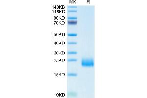 CCL24 Protein (AA 27-119) (His tag)