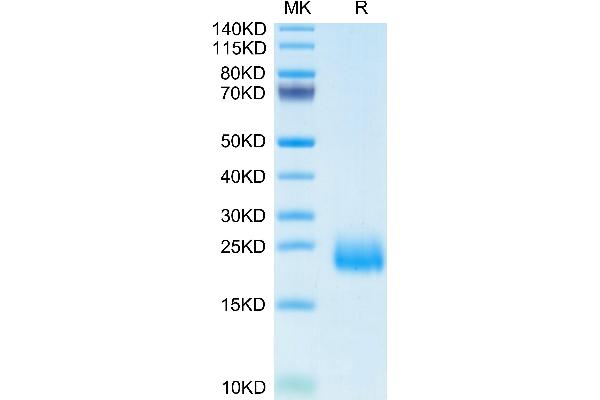 CCL24 Protein (AA 27-119) (His tag)