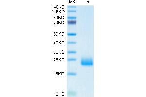Human CCL24 on Tris-Bis PAGE under reduced condition. (CCL24 Protein (AA 27-119) (His tag))