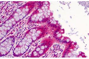 Human Colon: Formalin-Fixed, Paraffin-Embedded (FFPE) (SLFN12 antibody  (C-Term))