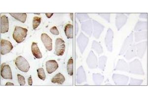 Immunohistochemistry analysis of paraffin-embedded human skeletal muscle tissue, using DUS2L Antibody. (DUSL2 antibody  (AA 421-470))