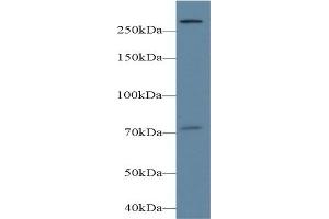 Detection of PLCe1 in Mouse Cerebrum lysate using Polyclonal Antibody to Phospholipase C Epsilon 1 (PLCe1) (PLCE1 antibody  (AA 1-250))