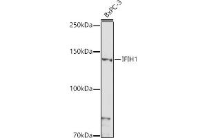 Western blot analysis of extracts of BxPC-3 cells, using IFIH1 antibody (ABIN6131879, ABIN6142174, ABIN6142175 and ABIN6217724) at 1:1000 dilution. (IFIH1 antibody  (AA 1-205))