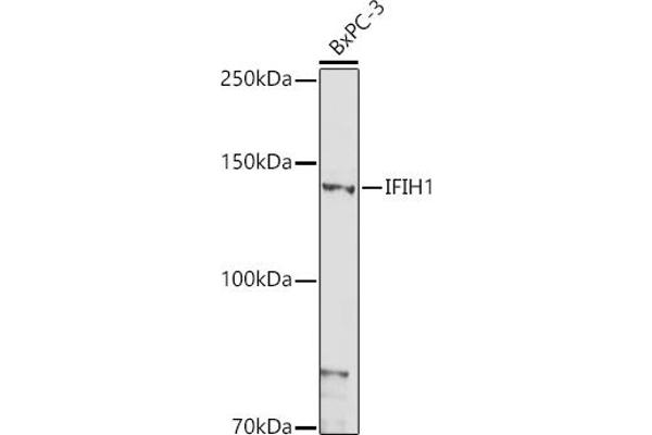 IFIH1 抗体  (AA 1-205)