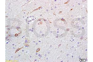 Formalin-fixed and rat brain tissue labeled with Anti-GABA Polyclonal Antibody, Unconjugated (ABIN679013) at 1:200 followed by conjugation to the secondary antibody and DAB staining (GABA antibody)
