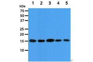 The cell lysates (40ug) were resolved by SDS-PAGE, transferred to PVDF membrane and probed with anti-human EIF5A antibody (1:1000). (EIF5A antibody)