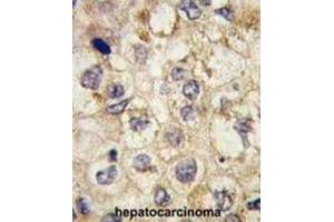 Immunohistochemistry (IHC) image for anti-Signal Sequence Receptor, alpha (SSR1) antibody (ABIN2997994) (SSR1 antibody)