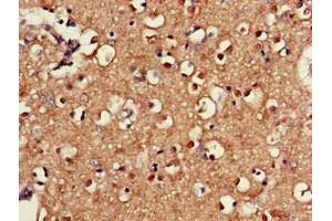 Immunohistochemistry of paraffin-embedded human brain tissue using ABIN7170561 at dilution of 1:100 (SAMD8 antibody  (AA 1-152))