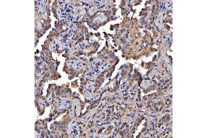 IHC analysis of Scavenging Receptor SRB2/SCARB2 using anti-Scavenging Receptor SRB2/SCARB2 antibody (ABIN7601833). (SCARB2 antibody  (AA 48-357))