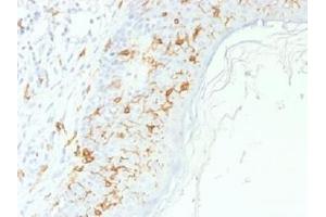 IHC testing of FFPE human skin with CD1a antibody. (CD1a antibody)
