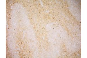 Immunohistochemistry of GCPII in human Medulla oblongata by monoclonal antibody. (PSMA antibody  (AA 44-750))