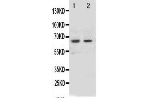 Anti-NOX1 antibody, Western blottingAll lanes: Anti NOX1  at 0. (NOX1 antibody  (Middle Region))