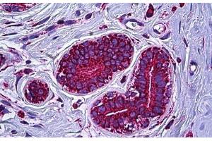 Human Breast: Formalin-Fixed, Paraffin-Embedded (FFPE) (ATP5A1 antibody  (AA 201-250))