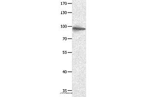 Western blot analysis of Hela cell, using HCN1 Polyclonal Antibody at dilution of 1:950 (HCN1 antibody)