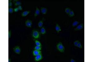 Immunofluorescence (IF) image for anti-Transmembrane Protein 38B (TMEM38B) (AA 249-291) antibody (ABIN7173386)