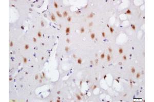 Formalin-fixed and paraffin embedded mouse brain labeled with Rabbit Anti-TNIK (Ser764) Polyclonal Antibody, Unconjugated (ABIN711941) at 1:200 followed by conjugation to the secondary antibody and DAB staining