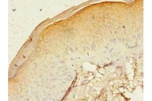 Immunohistochemistry (IHC) image for anti-Gap Junction Protein, beta 3, 31kDa (GJB3) (AA 211-270) antibody (ABIN7153613)