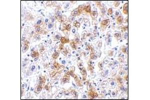 Immunohistochemistry of SCO2 in human liver tissue with this product at 2. (SCO2 antibody  (C-Term))
