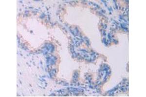 IHC-P analysis of Human Prostate Gland Tissue, with DAB staining. (IL-4 antibody  (AA 25-153))