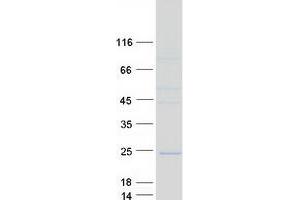 Validation with Western Blot