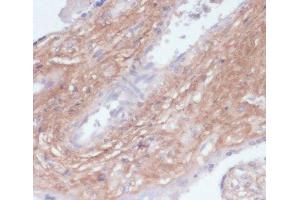 Immunohistochemistry of paraffin-embedded Human placenta using COL1A1 Polyclonal Antibody at dilution of 1:200 (40x lens). (COL1A1 antibody)