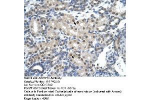 Immunohistochemistry (IHC) image for anti-Small Nuclear Ribonucleoprotein 70kDa (U1) (SNRNP70) (N-Term) antibody (ABIN2778715) (SNRNP70 antibody  (N-Term))