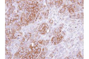IHC-P Image Immunohistochemical analysis of paraffin-embedded SW480 xenograft, using UST, antibody at 1:500 dilution. (UST antibody)