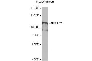 Western blot analysis of extracts of mouse spleen, using NFATC2 antibody (ABIN6292207) at 1:1000 dilution.