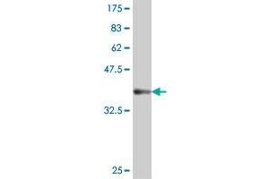 Western Blot detection against Immunogen (37. (NR1I2 antibody  (AA 279-378))