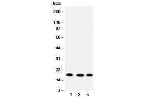 Western blot testing of UBC9 antibody and rat samples 1: heart (UBE2I antibody  (C-Term))